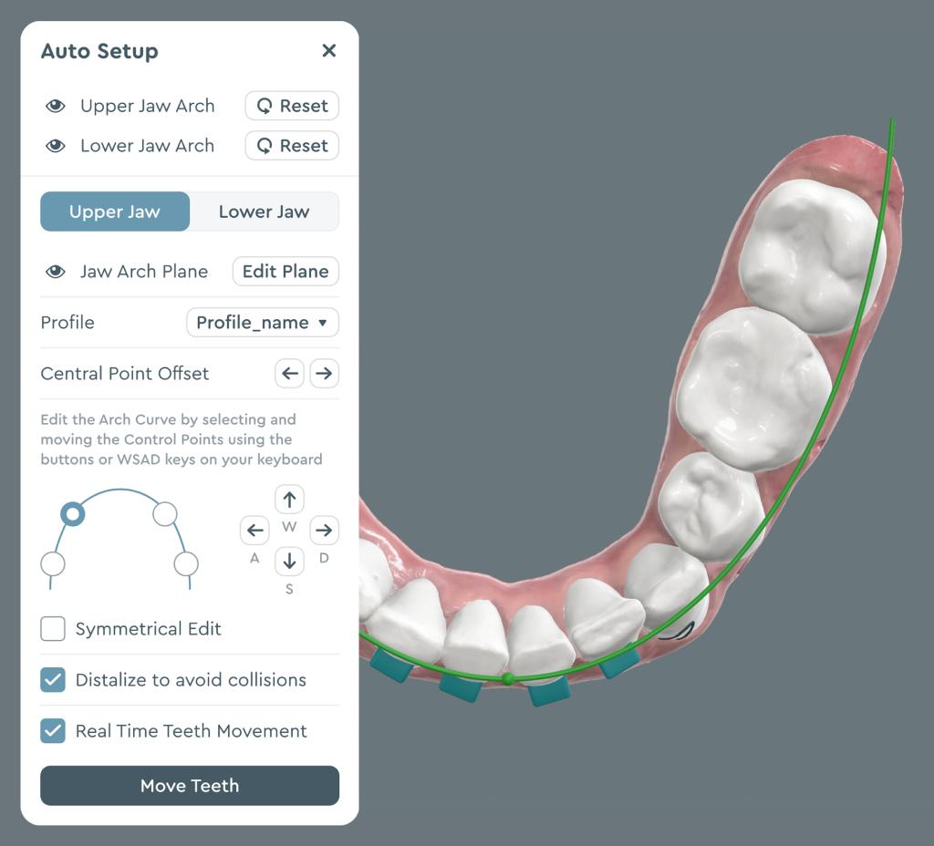 SoftSmile — Desktop and app interface Aligner treatment planning software