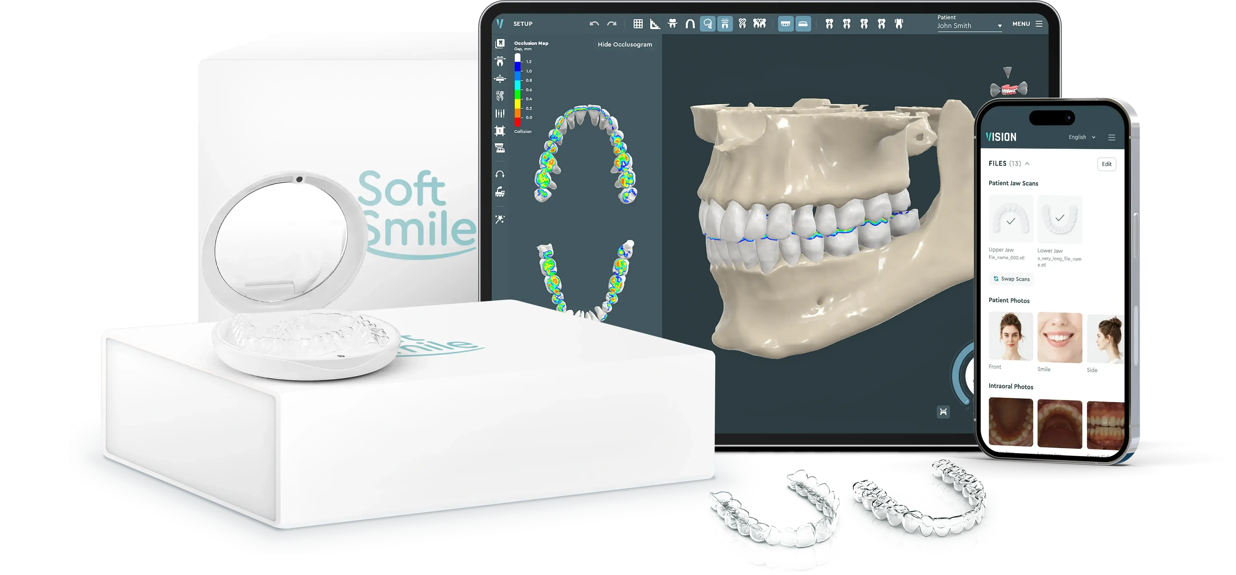 SoftSmile — Desktop and app interface Aligner treatment planning software