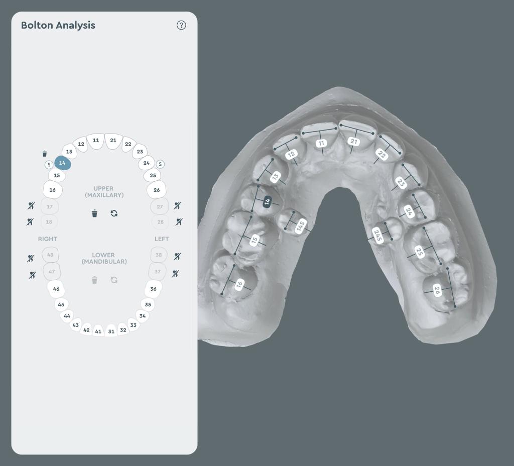 SoftSmile — Desktop and app interface Aligner treatment planning software