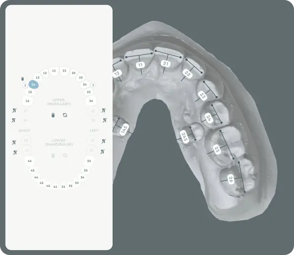 Design Around Complex Cases—Include Missing or Additional Teeth with Ease 3D model featuring impacted or supernumerary teeth within the treatment plan