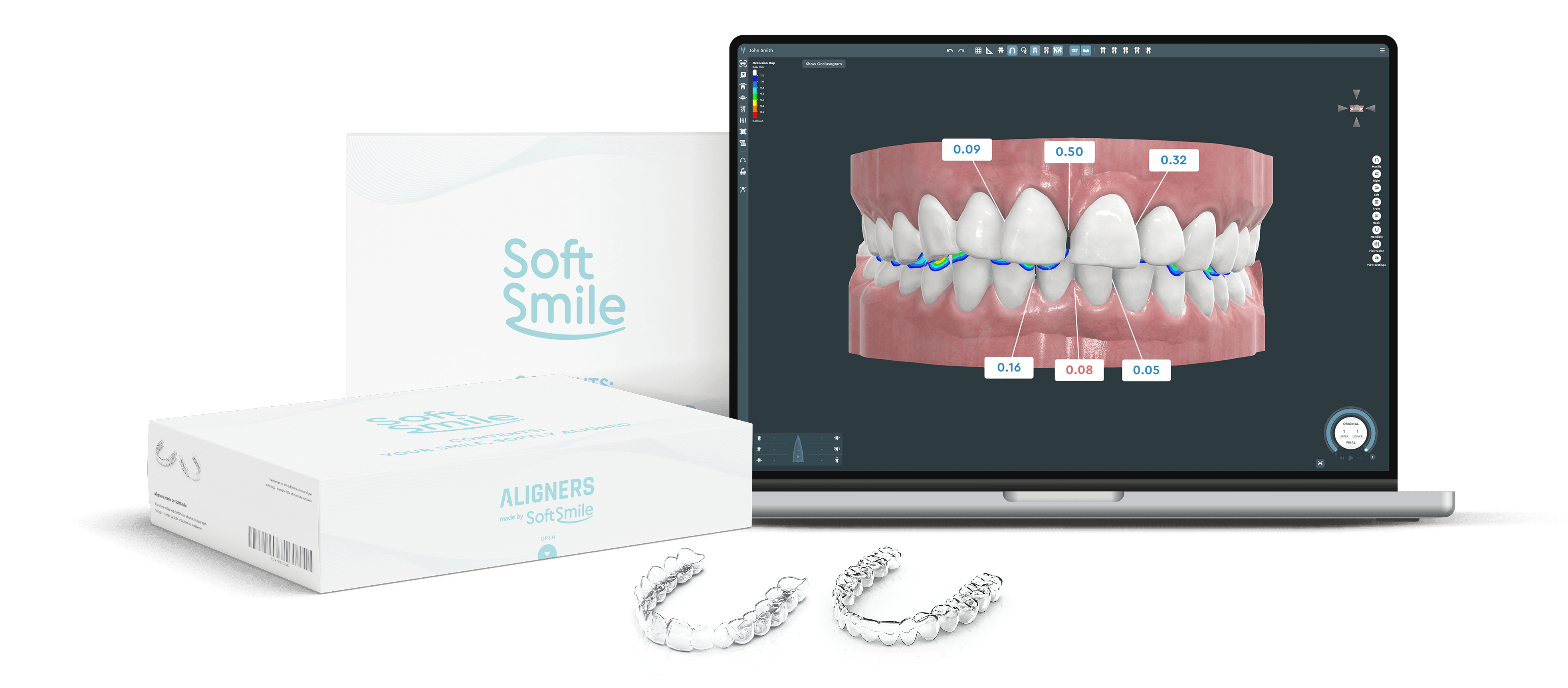 SoftSmile — Desktop and app interface Aligner treatment planning software